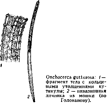 Доклад по теме Онхоцеркоз